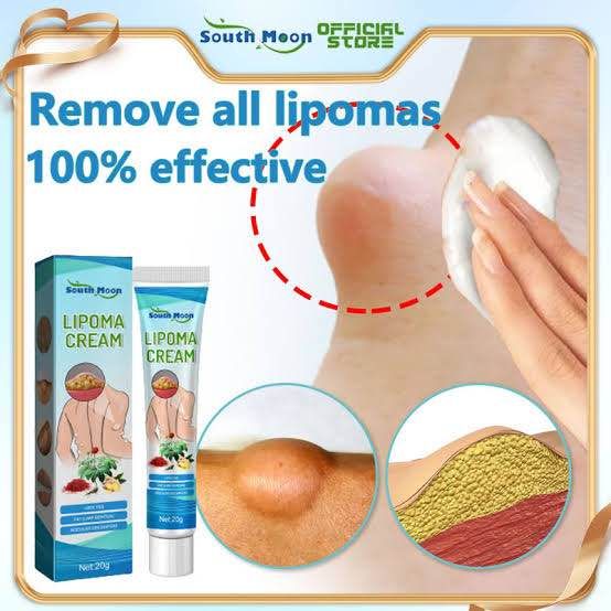 Lipoma Removal Cream