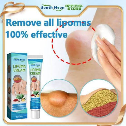 Lipoma Removal Cream