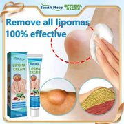 Lipoma Removal Cream