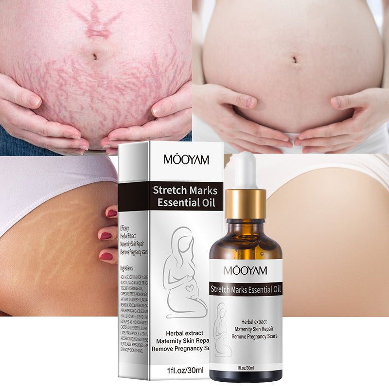 Stretch Marks Essential Oil