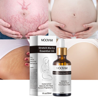 Stretch Marks Essential Oil