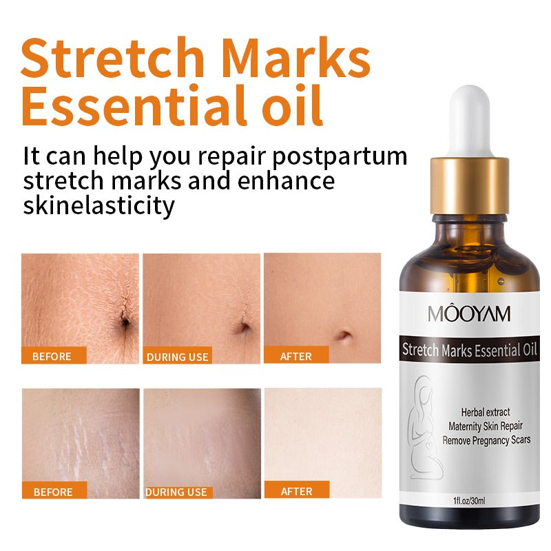 Stretch Marks Essential Oil