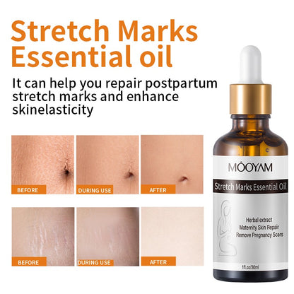 Stretch Marks Essential Oil