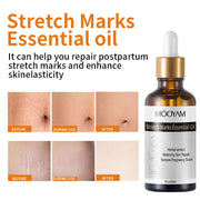 Stretch Marks Essential Oil