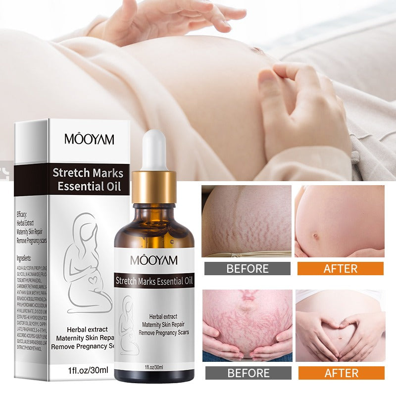 Stretch Marks Essential Oil